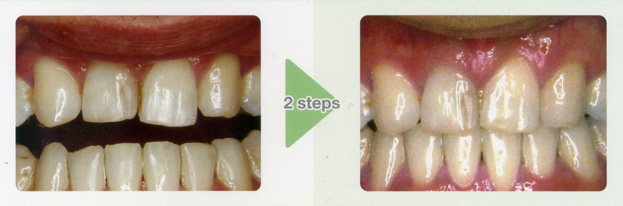 3_sp. Intrusion Case