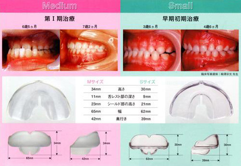 ムーシールド サイズ比較