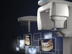 3Dパノラマレントゲン(歯科用X線CT装置)