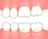 健全な歯の状態